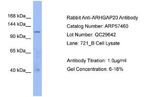WB Suggested Anti-ARHGAP20  Antibody Titration: 0.