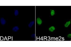 Immunofluorescence analysis of 293T cells using Symmetric DiMethyl-Histone H4-R3 antibody (ABIN3017488, ABIN3017489, ABIN3017490, ABIN1680265 and ABIN6220116). (Histone H4 Antikörper  (2meArg3))