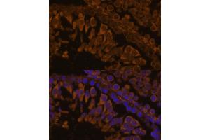 Immunofluorescence analysis of rat testis using ZPBP antibody (ABIN7271569) at dilution of 1:100. (ZPBP Antikörper  (AA 45-200))