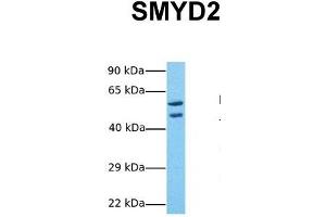 Host:  Rabbit  Target Name:  SMYD2  Sample Tissue:  Human 293T  Antibody Dilution:  1. (SMYD2A Antikörper  (Middle Region))