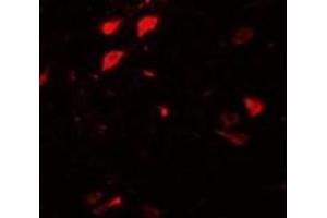 Immunofluorescence of DLCK3 in human brain tissue with AP30278PU-N DLCK3 antibody at 20 μg/ml. (DCLK3 Antikörper  (N-Term))