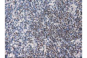 Image no. 6 for anti-Ankyrin Repeat Domain 53 (ANKRD53) (AA 1-300) antibody (ABIN1490720) (ANKRD53 Antikörper  (AA 1-300))