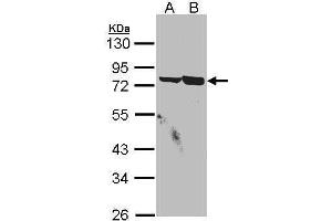 WB Image Sample(30 μg of whole cell lysate) A:A431, B:H1299 10% SDS PAGE antibody diluted at 1:1500 (SSX2IP Antikörper  (C-Term))