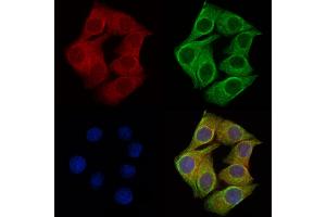 ABIN6257431 and ABIN6275975 staining Hela cells by IF/ICC. (PTH1R Antikörper  (Internal Region))