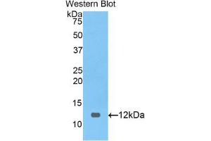Western blot analysis of the recombinant protein. (PRAME Antikörper  (AA 416-502))