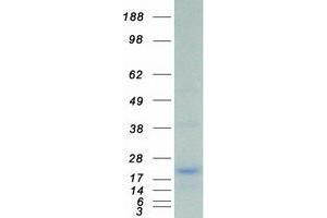 Western Blotting (WB) image for Ubiquitin-Conjugating Enzyme E2I (UBE2I) (Transcript Variant 2) protein (Myc-DYKDDDDK Tag) (ABIN2734776)