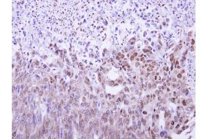 Immunohistochemistry (IHC) image for anti-MAF1 Homolog (MAF1) (Center) antibody (ABIN2856430)