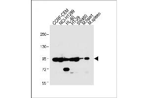 All lanes : Anti-NOD1 Antibody (C-term) at 1:2000 dilution Lane 1: CCRF-CEM whole cell lysate Lane 2: NCI- whole cell lysate Lane 3: HL-60 whole cell lysate Lane 4: HT-29 whole cell lysate Lane 5: S whole cell lysate Lane 6: Mouse heart lysate Lane 7: Mouse spleen lysate Lysates/proteins at 20 μg per lane. (NOD1 Antikörper  (C-Term))