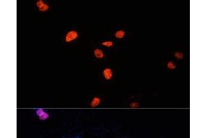 Immunofluorescence analysis of U-2 OS cells using KDM3A Polyclonal Antibody at dilution of 1:100 (40x lens). (KDM3A Antikörper)