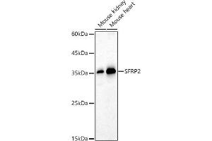 Western blot analysis of extracts of various cell lines, using SFRP2 antibody (ABIN6131355, ABIN6147675, ABIN6147677 and ABIN6221030) at 1:1000 dilution. (SFRP2 Antikörper  (AA 25-295))