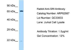 Western Blotting (WB) image for anti-Sorcin (SRI) (C-Term) antibody (ABIN2789324) (SRI Antikörper  (C-Term))