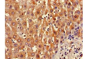 Immunohistochemistry of paraffin-embedded human liver tissue using ABIN7145367 at dilution of 1:100 (B3GALT2 Antikörper  (AA 201-422))