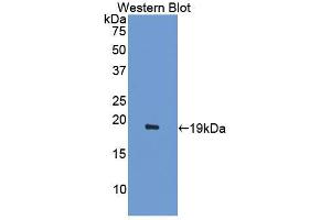Western blot analysis of the recombinant protein. (ACVR2A Antikörper  (AA 20-95))