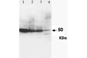Western Blot analysis of CCR6 expression from cell and tissue extracts with CCR6 polyclonal antibody . (CCR6 Antikörper  (N-Term))