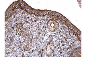 IHC-P Image T-Plastin antibody detects T-Plastin protein at cytoplasm on mouse cervix by immunohistochemical analysis. (Plastin 3 Antikörper)