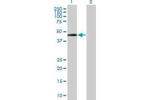 Lane 1: SLC16A1 transfected lysate ( 54 KDa) Lane 2: Non-transfected lysate. (SLC16A1 293T Cell Transient Overexpression Lysate(Denatured))