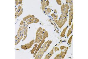 Immunohistochemistry of paraffin-embedded rat heart using MYO10 antibody (ABIN5974593) (40x lens). (Myosin X Antikörper)