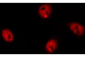 ABIN6274973 staining HeLa by IF/ICC. (CTDSP1 Antikörper  (N-Term))