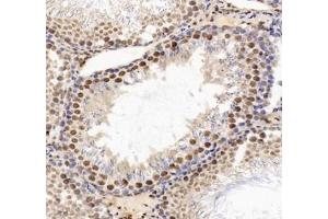 Immunohistochemistry analysis of paraffin-embedded rat testis using HNRNPM (ABIN7074247) at dilution of 1: 4000 (HnRNP M1-M4 Antikörper)