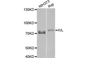 Western blot analysis of extracts of NIH3T3 and Raji cell lines, using IVL antibody. (Involucrin Antikörper)