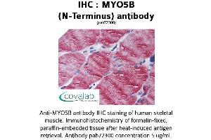Image no. 1 for anti-Myosin VB (MYO5B) antibody (ABIN1737170) (MYO5B Antikörper)