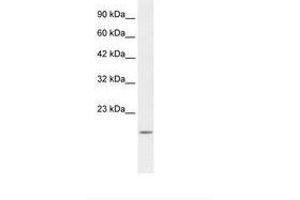 Image no. 2 for anti-BCL2-Associated X Protein (BAX) (N-Term) antibody (ABIN202051) (BAX Antikörper  (N-Term))