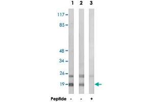 Western blot analysis of extracts from HepG2 cells (Lane 1 and lane 3) and HeLa cells (Lane 2), using RPL12 polyclonal antibody . (RPL12 Antikörper)