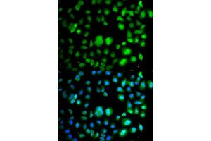 Immunofluorescence analysis of A549 cells using TET3 antibody. (TET3 Antikörper)