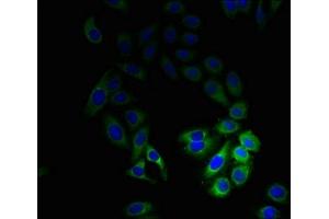 Immunofluorescent analysis of HepG2 cells using ABIN7147043 at dilution of 1:100 and Alexa Fluor 488-congugated AffiniPure Goat Anti-Rabbit IgG(H+L) (M6PR Antikörper  (AA 1-277))