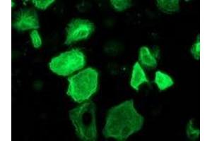 Anti-RASSF1 mouse monoclonal antibody (ABIN2454254) immunofluorescent staining of COS7 cells transiently transfected by pCMV6-ENTRY RASSF1 (RC213525). (RASSF1 Antikörper)