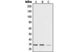 Western blot analysis of 14-3-3 zeta expression in HeLa (A), mouse brain (B), rat kidney (C) whole cell lysates. (14-3-3 zeta Antikörper  (Center))