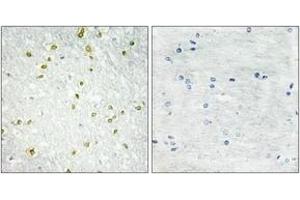 Immunohistochemistry (IHC) image for anti-Small Nuclear RNA Activating Complex, Polypeptide 5, 19kDa (SNAPC5) (AA 10-59) antibody (ABIN1533550)