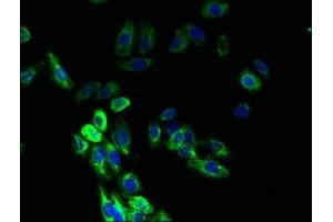 Immunofluorescent analysis of HepG2 cells using ABIN7145066 at dilution of 1:100 and Alexa Fluor 488-congugated AffiniPure Goat Anti-Rabbit IgG(H+L) (DARC Antikörper  (AA 1-63))