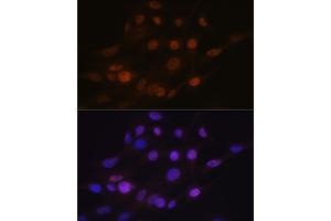 Immunofluorescence analysis of C6 cells using B Rabbit mAb (ABIN7265377) at dilution of 1:100 (40x lens). (ANP32B Antikörper)