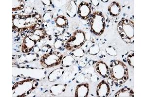 Immunohistochemical staining of paraffin-embedded Kidney tissue using anti-FAHD2Amouse monoclonal antibody. (FAHD2A Antikörper)