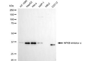 Western blotting analysis using NFKB inhibitor alpha antibody (ABIN7799643).