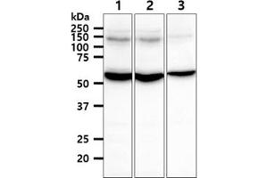 The cell lysates (40ug) were resolved by SDS-PAGE, transferred to PVDF membrane and probed with anti-human TXNRD1 antibody (1:1000). (TXNRD1 Antikörper)