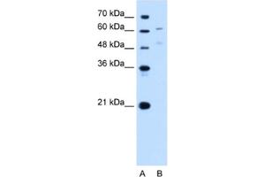 Western Blotting (WB) image for anti-UDP Glucuronosyltransferase 1 Family, Polypeptide A4 (UGT1A4) antibody (ABIN2463019) (UGT1A4 Antikörper)