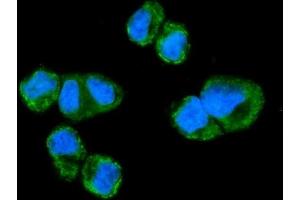 IF analysis of NDUFAF1 using anti-NDUFAF1 antibody (ABIN7602459).