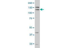 NRP1 monoclonal antibody (M05), clone 1B3 Western Blot analysis of NRP1 expression in HeLa . (Neuropilin 1 Antikörper  (AA 22-131))