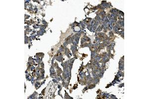 IHC analysis of ME2 using anti-ME2 antibody (ABIN7600967). (NAD-ME Antikörper  (AA 26-584))