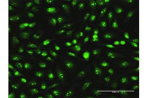Immunofluorescence of monoclonal antibody to SKP1 on HeLa cell. (SKP1 Antikörper  (AA 53-160))