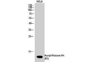 Western Blotting (WB) image for anti-Histone H4 (acLys5) antibody (ABIN3181870) (Histone H4 Antikörper  (acLys5))