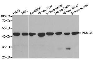 Western blot analysis of extracts of various cell lines, using PSMC6 antibody. (PSMC6 Antikörper  (AA 20-150))