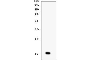 Western blot analysis of CCL6 using anti-CCL6 antibody (ABIN6719644).