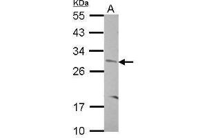 WB Image Sample (30 ug of whole cell lysate) A: SK-N-SH 12% SDS PAGE antibody diluted at 1:500 (CNOT8 Antikörper)