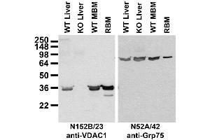 Immunoblot against membranes from livers of wild-type (WT) and VDAC1 knockout (KO) mice and brains of WT mice (MBM) and rat (RBM).