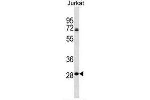 RPL11 Antibody (N-term) western blot analysis in Jurkat cell line lysates (35µg/lane).