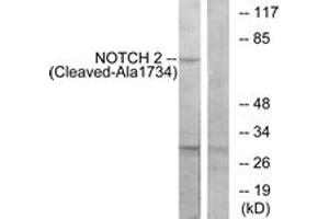 Western blot analysis of extracts from Jurkat cells, treated with etoposide 25uM 24h, using NOTCH2 (Cleaved-Ala1734) Antibody. (NOTCH2 Antikörper  (Cleaved-Ala1734))