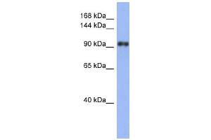 WB Suggested Anti-LAntibody Titration:  0. (LARP1 Antikörper  (N-Term))
